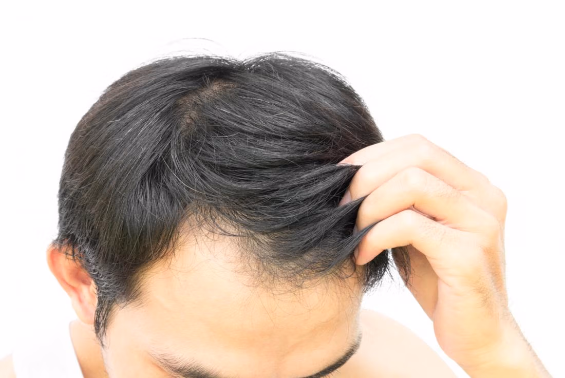 stem cells for regrowth in 2024