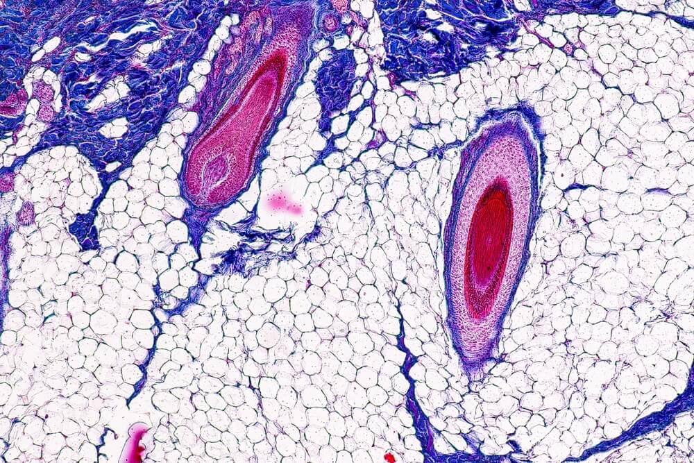 stem cell therapy for male hair loss