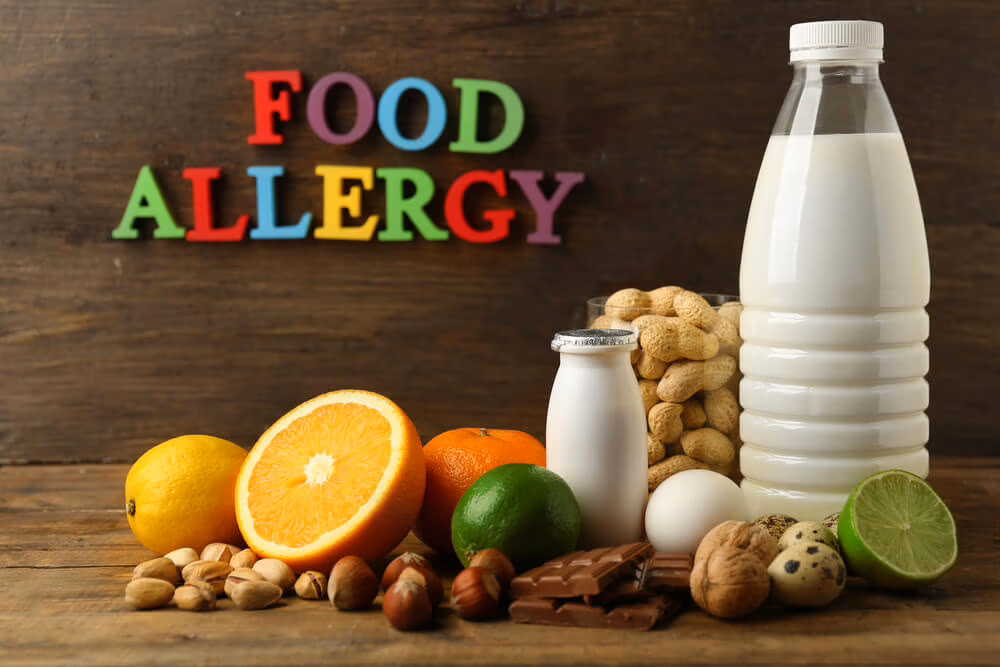 Food Allergies In 2026