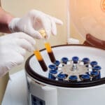 เกล็ดเลือดเข้มข้น