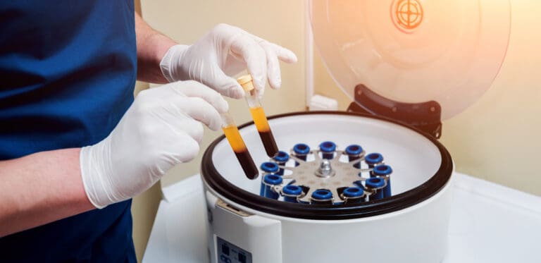 Platelet-Rich Plasma